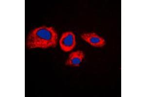 anti-Ribosomal Protein S4, Y-Linked 1 (RPS4Y1) (C-Term) antibody