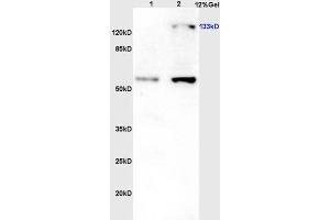Lane 1: Rat brain lysates; Lane 2: Rat liver lysates probed with Rabbit Anti-eNOS (Thr113) Polyclonal Antibody (ABIN701245) at 1:300 overnight in 4 °C. (ENOS anticorps  (pThr113))