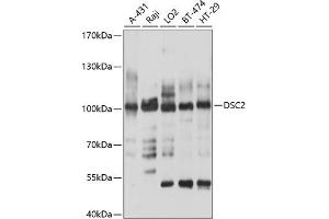 Western blot analysis of extracts of various cell lines, using DSC2 antibody (ABIN6127802, ABIN6139827, ABIN6139828 and ABIN6214372) at 1:1000 dilution. (Desmocollin 2 anticorps  (AA 520-690))