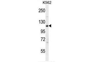 CFH Antibody (Center) western blot analysis in K562 cell line lysates (35µg/lane). (Complement Factor H anticorps  (Middle Region))