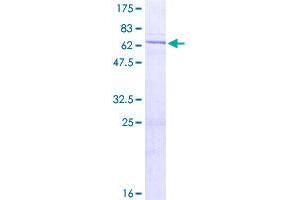 Image no. 1 for Dual Specificity Phosphatase 11 (RNA/RNP Complex 1-Interacting) (DUSP11) (AA 1-330) protein (GST tag) (ABIN1352100)