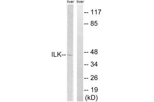 Western Blotting (WB) image for anti-Integrin-Linked Kinase (ILK) (Ser246) antibody (ABIN1848219) (ILK anticorps  (Ser246))