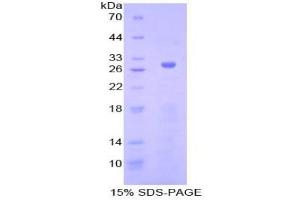 SDS-PAGE analysis of Human Adenylate Cyclase 5 Protein. (ADCY5 Protéine)