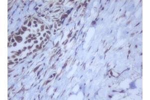 Image no. 5 for anti-DEAD (Asp-Glu-Ala-Asp) Box Polypeptide 59 (DDX59) (AA 1-303) antibody (ABIN1490728) (DDX59 anticorps  (AA 1-303))