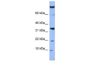 WB Suggested Anti-FAM178B Antibody Titration: 0. (FAM178B anticorps  (Middle Region))