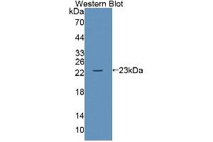 Western blot analysis of the recombinant protein. (ABCA9 anticorps  (AA 1422-1589))