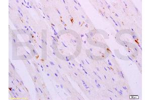 Formalin-fixed and paraffin embedded mouse heart tissue labeled with Anti-Cathepsin K Polyclonal Antibody, Unconjugated (ABIN732038) at 1:200 followed by conjugation to the secondary antibody, (SP-0023), and DAB staining (Cathepsin K anticorps)