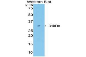 Western blot analysis of the recombinant protein. (LRP3 anticorps  (AA 184-435))