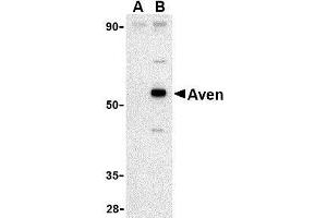 Western blot analysis of Aven in Raji cell lysate with AP30098PU-N Aven antibody at 1 μg/ml in (A) the presence and (B) the absence of blocking peptide. (AVEN anticorps  (C-Term))
