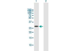Western Blot analysis of FAM60A expression in transfected 293T cell line by FAM60A MaxPab polyclonal antibody. (FAM60A anticorps  (AA 1-221))