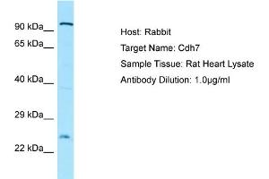 WB Suggested Anti-Cdh7 Antibody   Titration: 1. (Cadherin 7 anticorps  (N-Term))