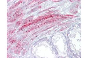 Anti-TRPM8 antibody IHC of human prostate.