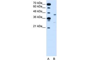 Western Blotting (WB) image for anti-G Protein-Coupled Receptor 161 (GPR161) antibody (ABIN2462573) (GPR161 anticorps)