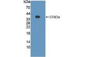 Detection of Recombinant FLII, Human using Polyclonal Antibody to Flightless I Homolog (FLII)