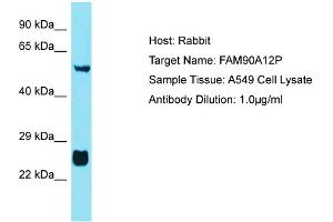 Host: Rabbit Target Name: FAM90A12P Sample Tissue: Human A549 Whole Cell Antibody Dilution: 1ug/ml (FAM90A12P anticorps  (Middle Region))