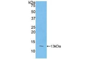 WB of Protein Standard: different control antibodies against Highly purified E.