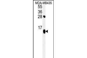 ATP5D Antibody (N-term) (ABIN652148 and ABIN2840566) western blot analysis in MDA-M cell line lysates (35 μg/lane). (ATP5F1D anticorps  (N-Term))