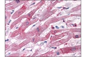 Immunohistochemistry Image: Human Heart: Formalin-Fixed, Paraffin-Embedded (FFPE) (BAG3 anticorps  (C-Term))