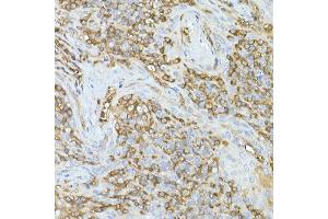 Immunohistochemistry of paraffin-embedded human tonsil using C Rabbit mAb (ABIN7266058) at dilution of 1:50 (40x lens). (CAP1 anticorps)