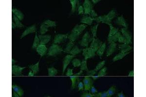 Immunofluorescence analysis of C6 cells using DDX3Y Polyclonal Antibody at dilution of 1:100 (40x lens). (DDX3Y anticorps)