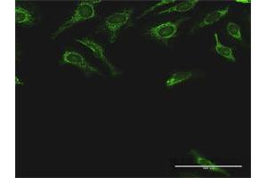 Immunofluorescence of purified MaxPab antibody to DLST on HeLa cell.