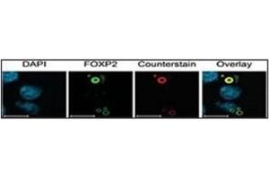 Characterization of FOXP2 isoforms using FOXP2 Ab (green) and Ubiquitin antibody (aggresome marker) (red).