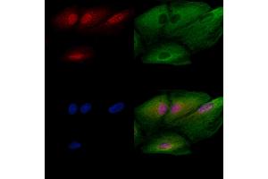 ABIN6260274 and ABIN6272782 staining  cells by IF/ICC. (ARNTL anticorps  (Internal Region))
