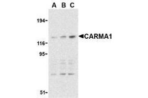 Western blot analysis of CARMA1 expression in mouse thymus cell lysate with AP30186PU-N CARMA1 antibody at 0. (CARD11 anticorps)