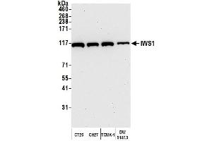 Western Blotting (WB) image for anti-IWS1 Homolog (IWS1) (AA 1-50) antibody (ABIN7449756) (IWS1 anticorps  (AA 1-50))
