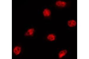 ABIN6275323 staining MCF7 by IF/ICC.