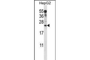 ANKRD22 Antibody (C-term) (ABIN657584 and ABIN2846587) western blot analysis in HepG2 cell line lysates (35 μg/lane). (ANKRD22 anticorps  (C-Term))