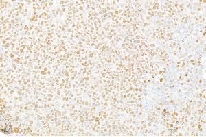anti-Matrin 3 (MATR3) (C-Term) antibody