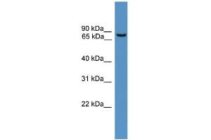 WB Suggested Anti-BBS2 Antibody Titration: 1. (BBS2 anticorps  (N-Term))