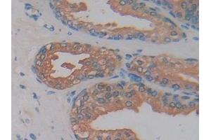 Detection of KLK2 in Human Prostate Tissue using Polyclonal Antibody to Kallikrein 2 (KLK2)