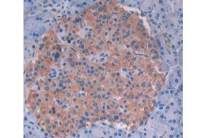 IHC-P analysis of Human Tissue, with DAB staining. (PVRL4 anticorps  (AA 31-317))