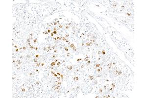 Immunohistochemistry (IHC) image for anti-Topo IIalpha (AA 650-700) antibody (ABIN7795795) (Recombinant Topo IIalpha (AA 650-700) anticorps)