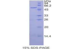 SDS-PAGE analysis of Human SIAE Protein.