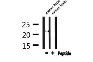 Western blot analysis of extracts from mouse brain, using FGF20 Antibody.