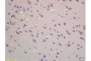 Formalin-fixed and paraffin embedded rat brain labeled with Rabbit Anti ADORA1 Polyclonal Antibody, Unconjugated (ABIN705656) at 1:200 followed by conjugation to the secondary antibody and DAB staining (ADORA1 anticorps  (AA 151-250))