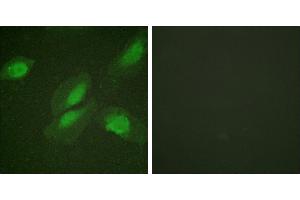 Peptide - +Immunofluorescence analysis of HeLa cells, using Akt (Ab-326) antibody. (AKT1 anticorps)