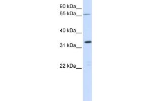 WB Suggested Anti-C19orf47 Antibody Titration:  0. (C19orf47 anticorps  (Middle Region))