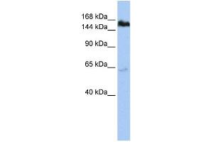 WB Suggested Anti-TNKS Antibody Titration:  1 ug/ml  Positive Control:  HepG2 cell lysate (TNKS anticorps  (Middle Region))
