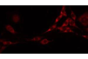 ABIN6277863 staining Hela by IF/ICC. (FLT3LG anticorps  (C-Term))