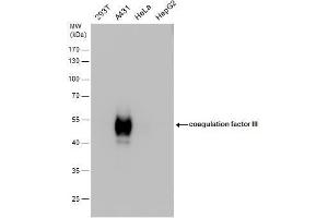 WB Image Tissue factor antibody detects Tissue factor protein by western blot analysis.