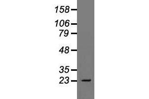 Western blot analysis of 35 µg of cell extracts from human Liver carcinoma (HepG2) cells using anti-TNNI3 antibody. (TNNI3 anticorps)