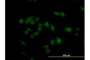 Immunofluorescence of monoclonal antibody to CARF on HeLa cell. (CDKN2AIP anticorps  (AA 1-579))