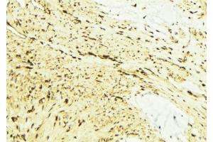 ABIN6276577 at 1/100 staining Mouse muscle tissue by IHC-P. (FAAH anticorps)