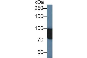 Detection of NAGLU in Human Urine using Polyclonal Antibody to N-Acetyl Alpha-D-Glucosaminidase (NAGLU)
