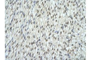 Rabbit Anti-EXOSC7 antibody   Paraffin Embedded Tissue: Human Heart cell Cellular Data: cardiac cell of renal tubule Antibody Concentration: 4.