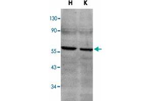 Western blot analysis of TNFRSF10B in HeLa (H) and K-562 (K) cell lysates with TNFRSF10B polyclonal antibody  at 2 ug/mL . (TNFRSF10B anticorps  (C-Term))
